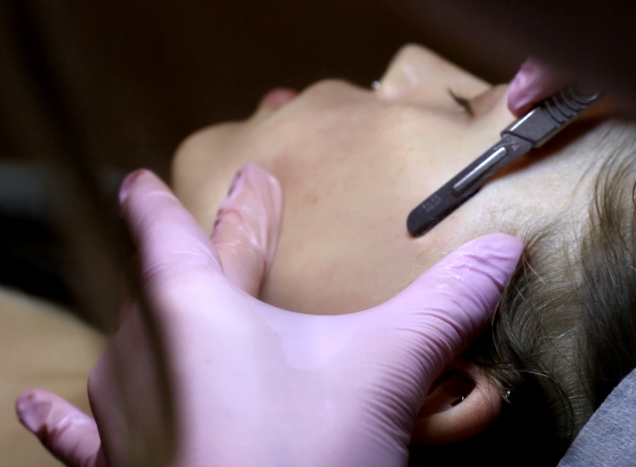 Dermaplaning treatment in progress at SÉAMI